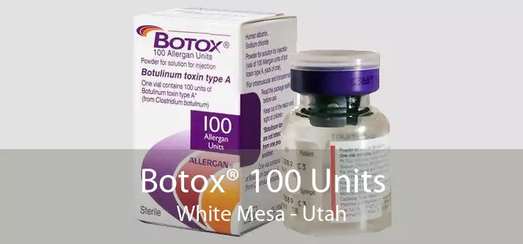 Botox® 100 Units White Mesa - Utah