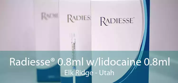 Radiesse® 0.8ml w/lidocaine 0.8ml Elk Ridge - Utah